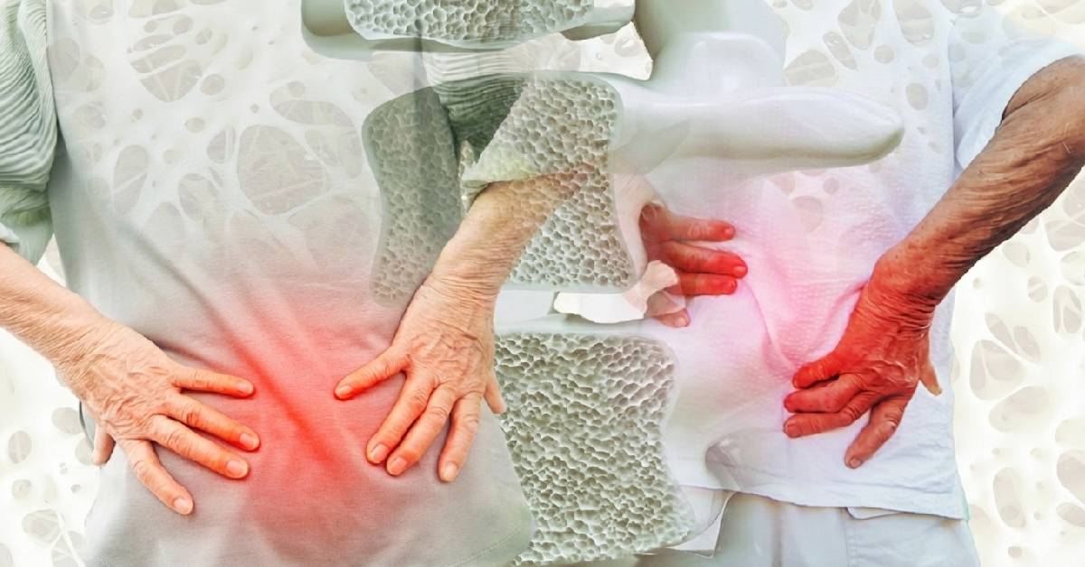 ‘กระดูกพรุน’ ในผู้ชาย ความเสี่ยงสุขภาพ ร่างกายส่งสัญญาณ ‘ปวดหลังเรื้อรัง’